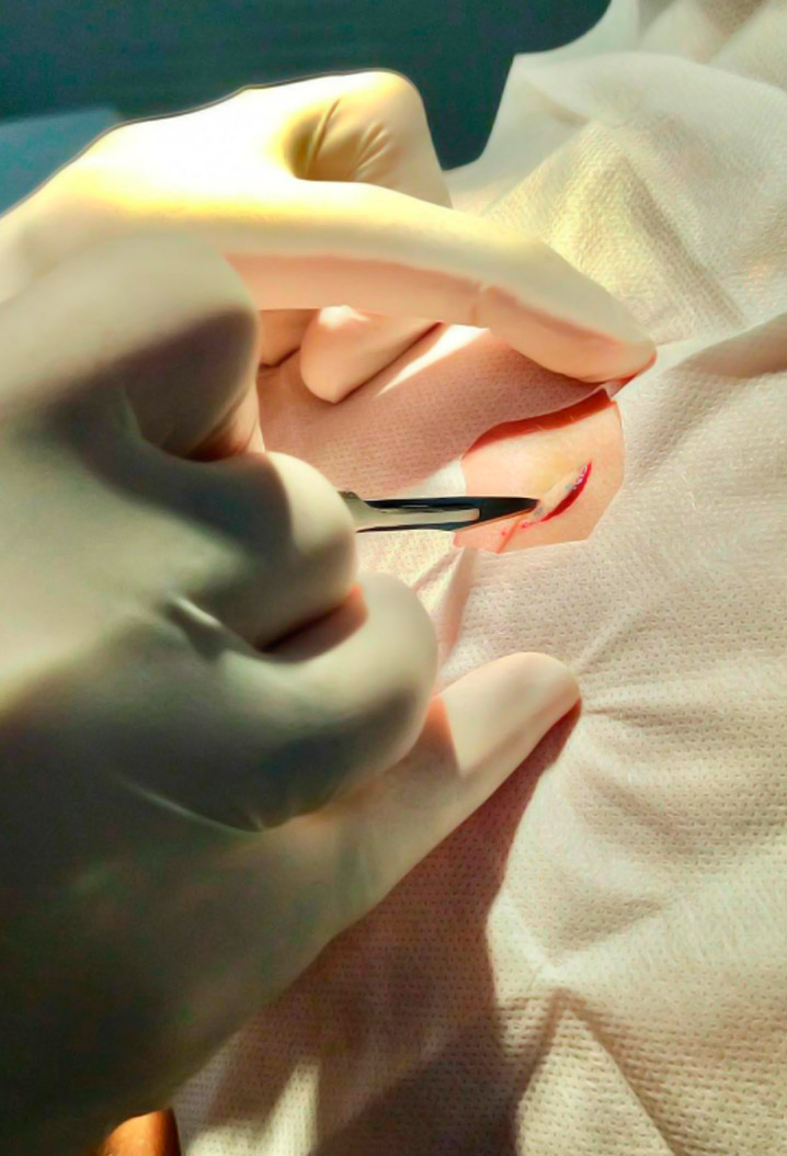 dermcenter-cirurgia-dermatologica-1