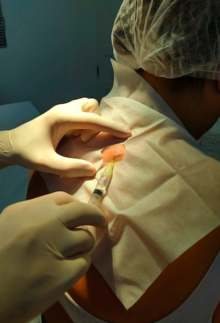 dermcenter-cirurgia-dermatologica-2