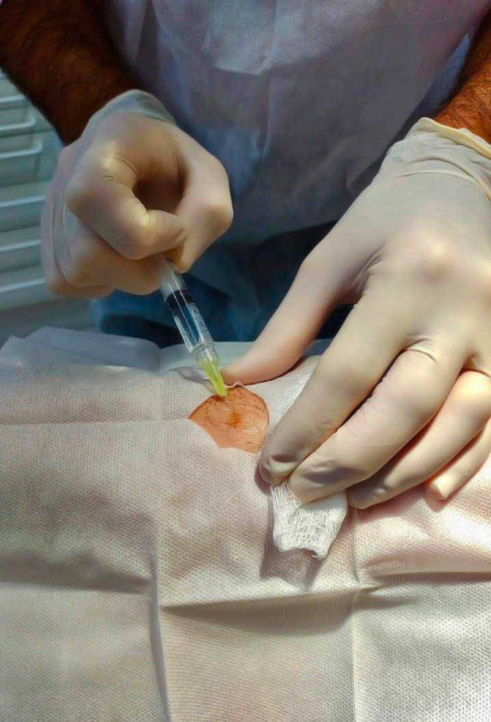 dermcenter-cirurgia-dermatologica-3