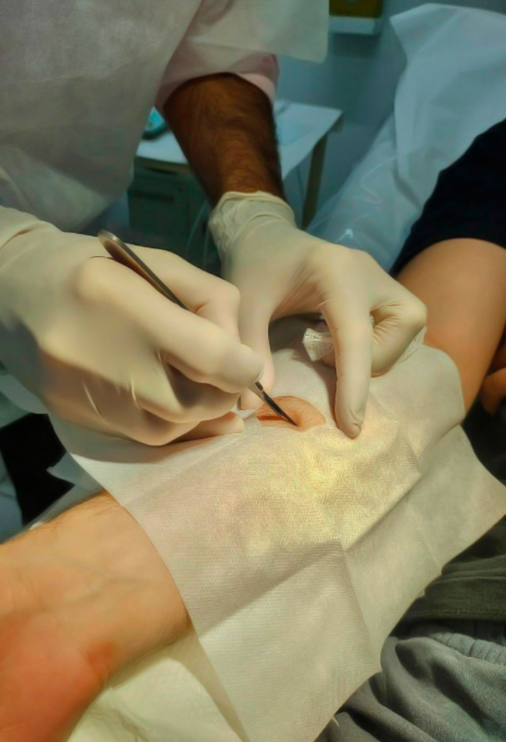 dermcenter-cirurgia-dermatologica-4